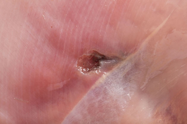 Lead shotgun hole in a pheasant breast 